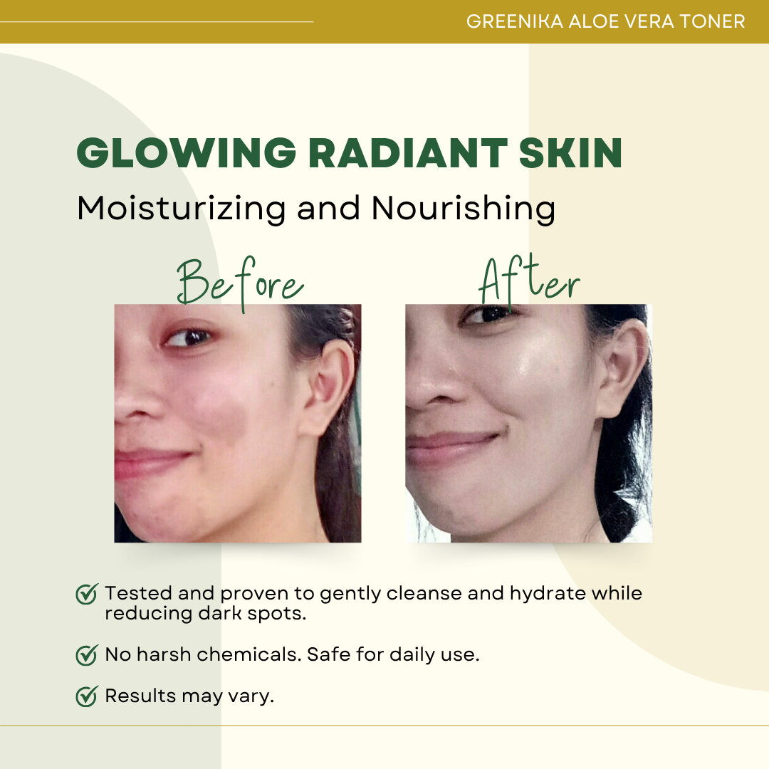 Greenika Aloe Vera Facial Toner Rich in Vitamin E