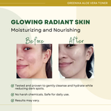 Greenika Aloe Vera Facial Toner Rich in Vitamin E