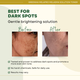 Greenika Anti Melasma Melaclear Dark Spot Remover Solution