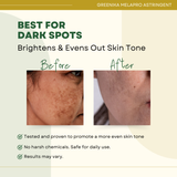 Greenika Anti Melasma Melaclear Astringent Solution