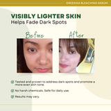 Greenika Bleaching Serum