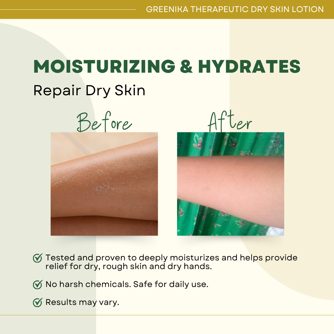 Greenika Moisturizing Lotion for Dry Skin