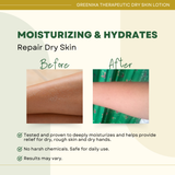 Greenika Moisturizing Lotion for Dry Skin