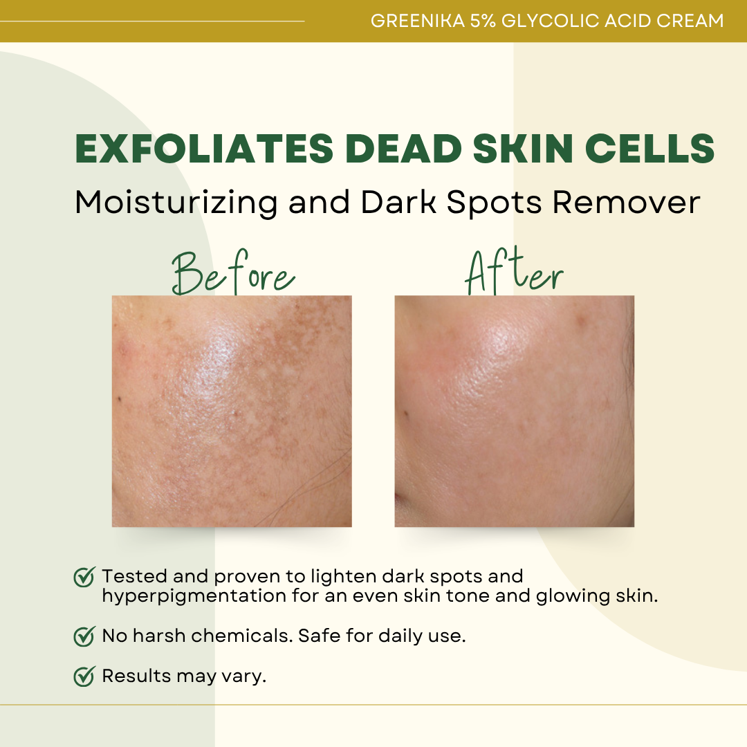 Greenika Glycolic Acid 5% Exfoliating Cream