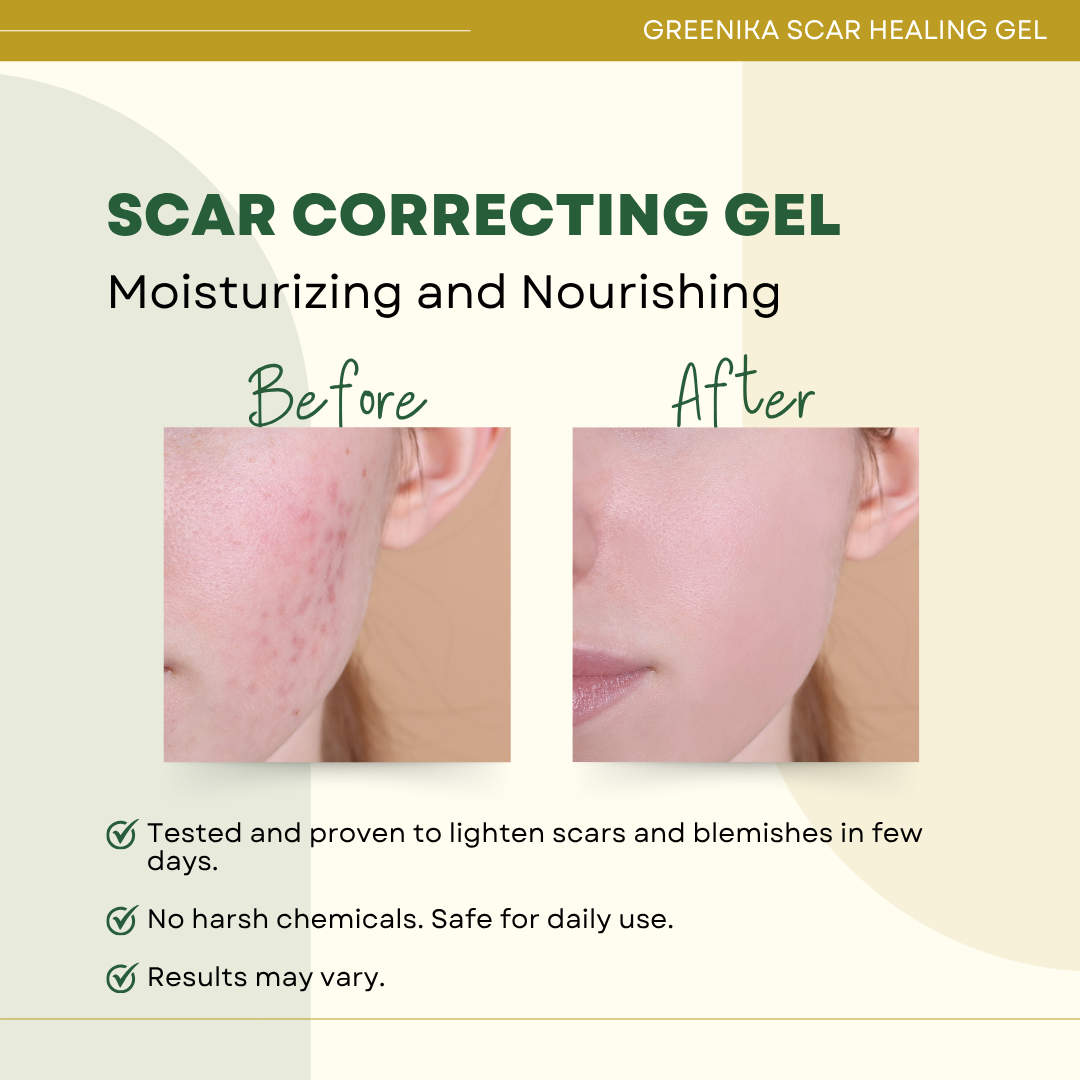 Greenika Scar Healing Gel