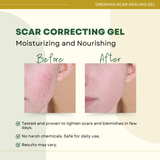 Greenika Scar Healing Gel