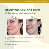 Greenika Aloe Vera Skin Care Set