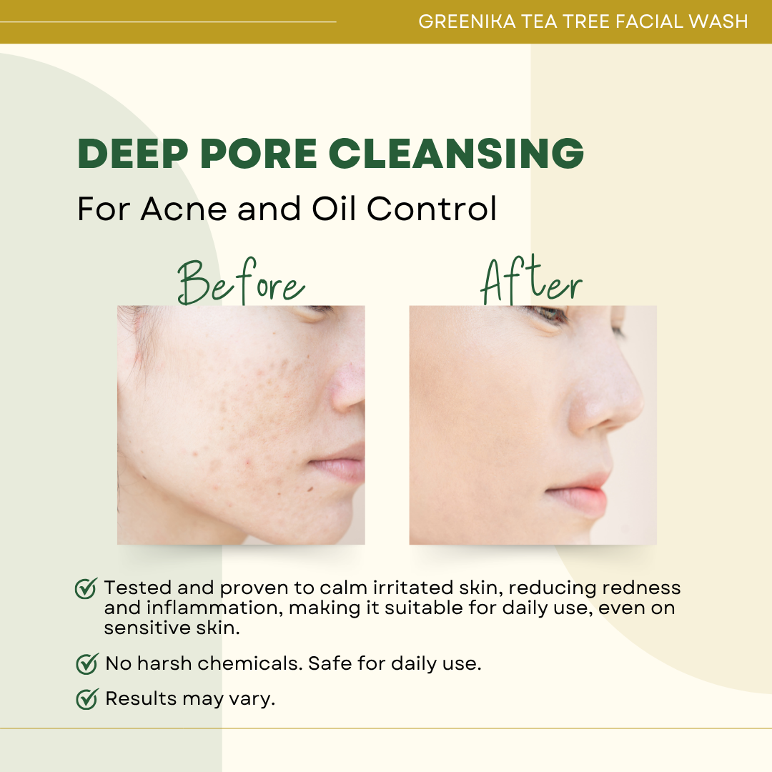 Greenika Tea Tree Anti Acne Facial Cleanser