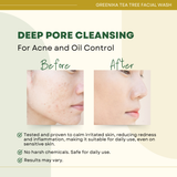 Greenika Tea Tree Anti Acne Facial Cleanser