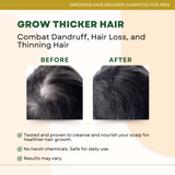 Greenika for Men Hair Grower