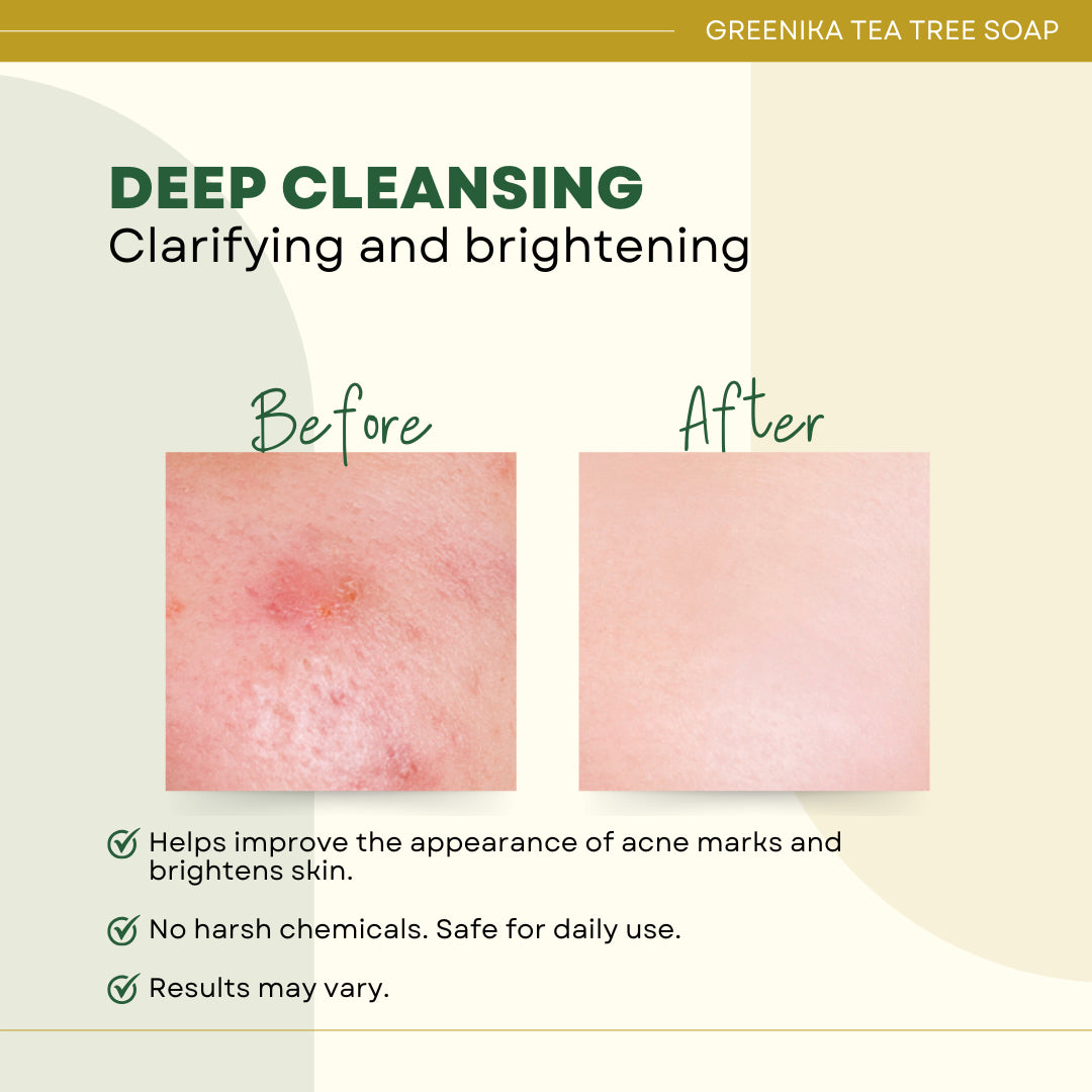 Greenika Organic Tea Tree Soap