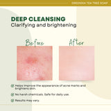 Greenika Organic Tea Tree Soap