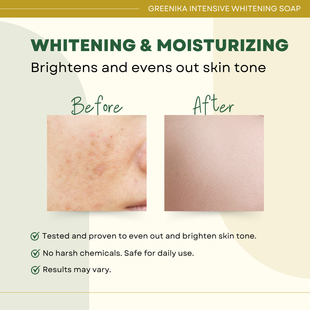 Greenika Organic Intensive Whitening Soap