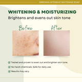 Greenika Organic Intensive Whitening Soap