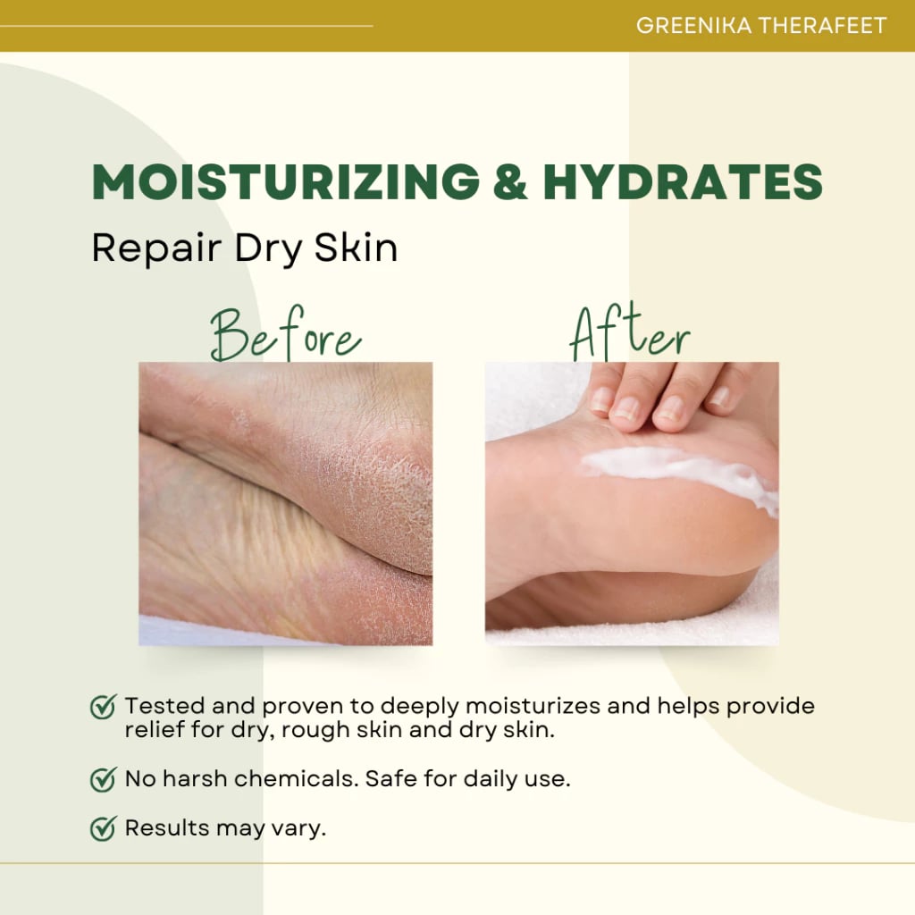 Greenika Therafeet Foot Repair Cream