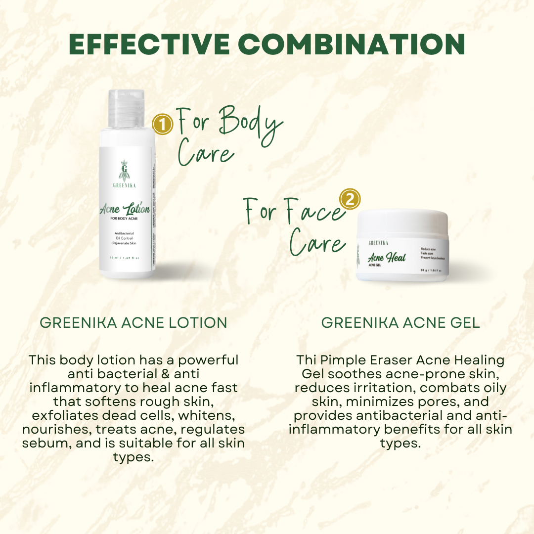 Greenika 50ML Acne Lotion + 30G Acne Heal Gel Bundle