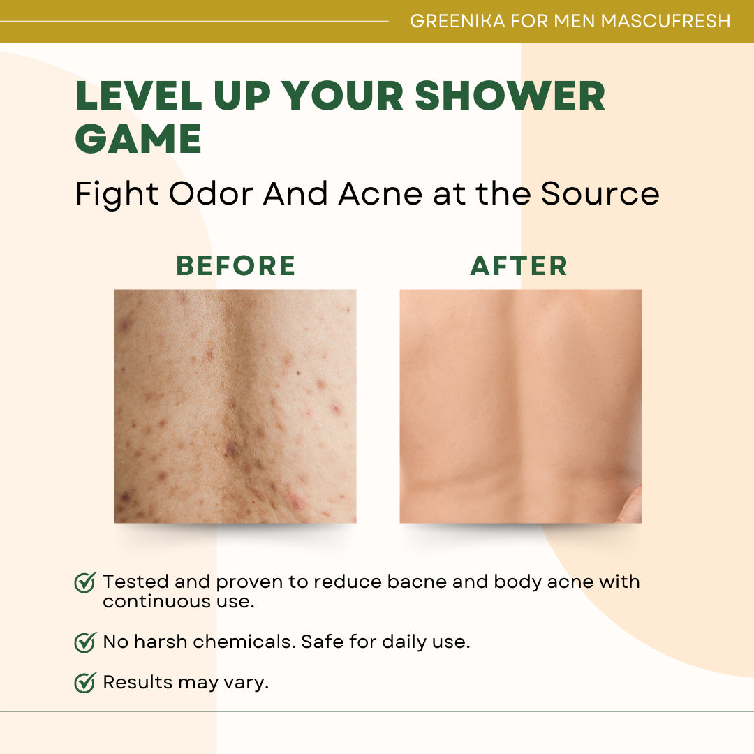 [ ANTI ODOR BODY WASH ] Greenika for Men Mascufresh Body Wash Shower Gel Cleanser with Salicylic Acid Cleanses Deeply Unclogs Pores Anti Bacterial Removes Bacne Arms Acne Body Acne Fungal Acne Whiteheads Blackheads Shoulders Pimple Remover for men