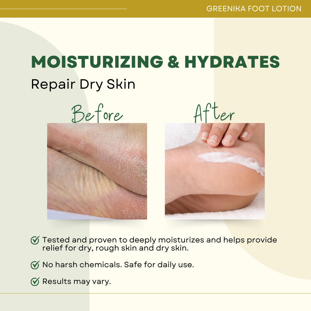 Greenika Natural Foot Cream Lotion