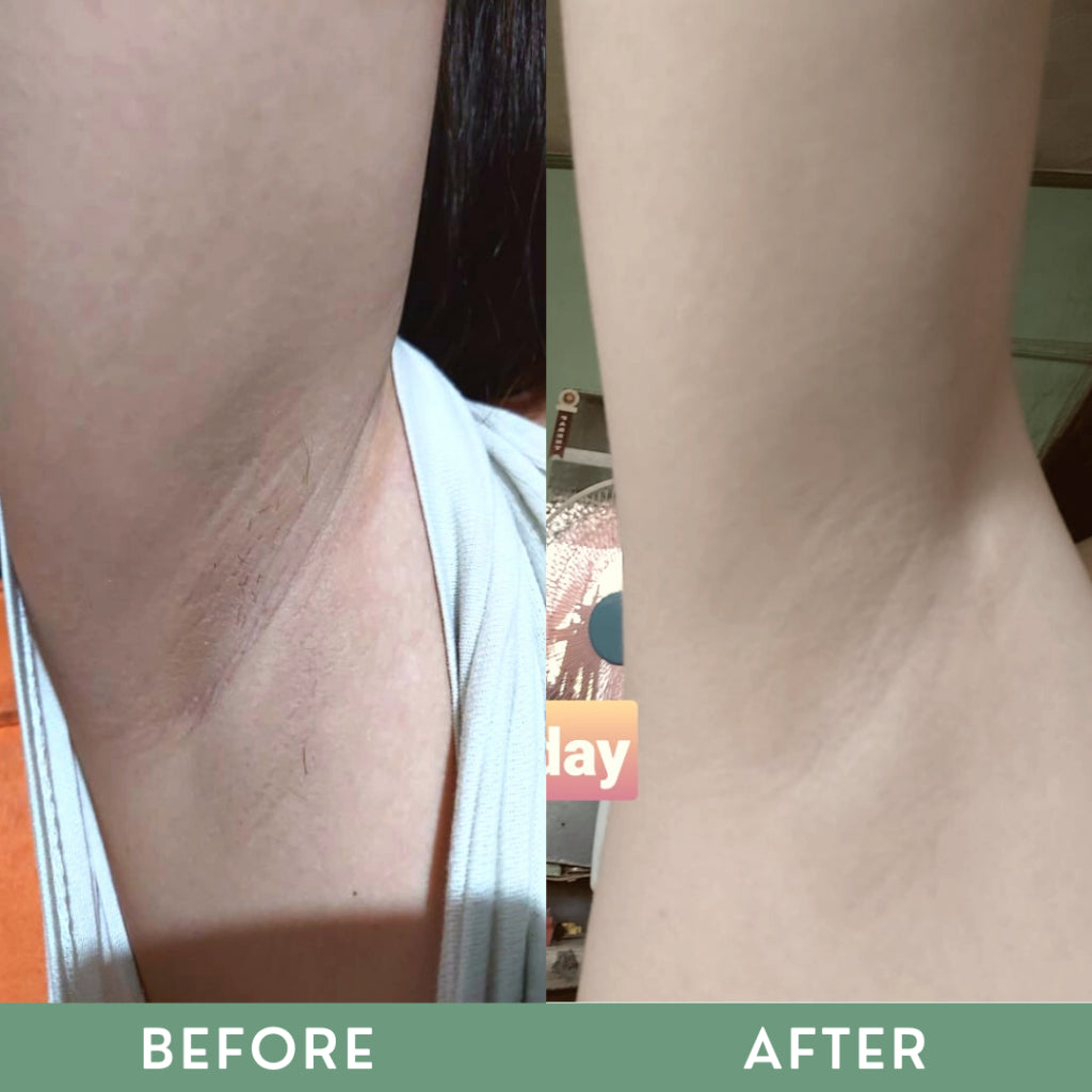 Greenika Underarm Peeling Cream