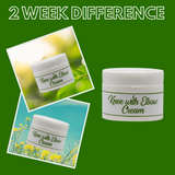 Greenika Knee and Elbow Whitening Cream