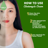 Greenika Clindamycin Cream Anti-Acne Gel