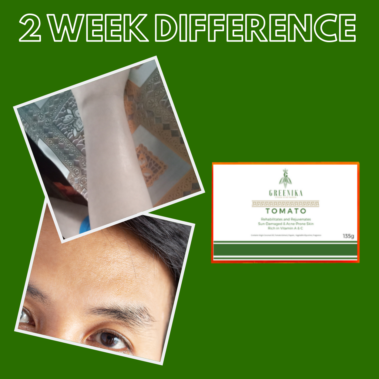 Greenika Premium Organic Tomato Natural Whitening Anti Wrinkle Soap