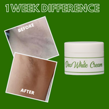 Greenika DeoWhite Cream for Whiter Armpits